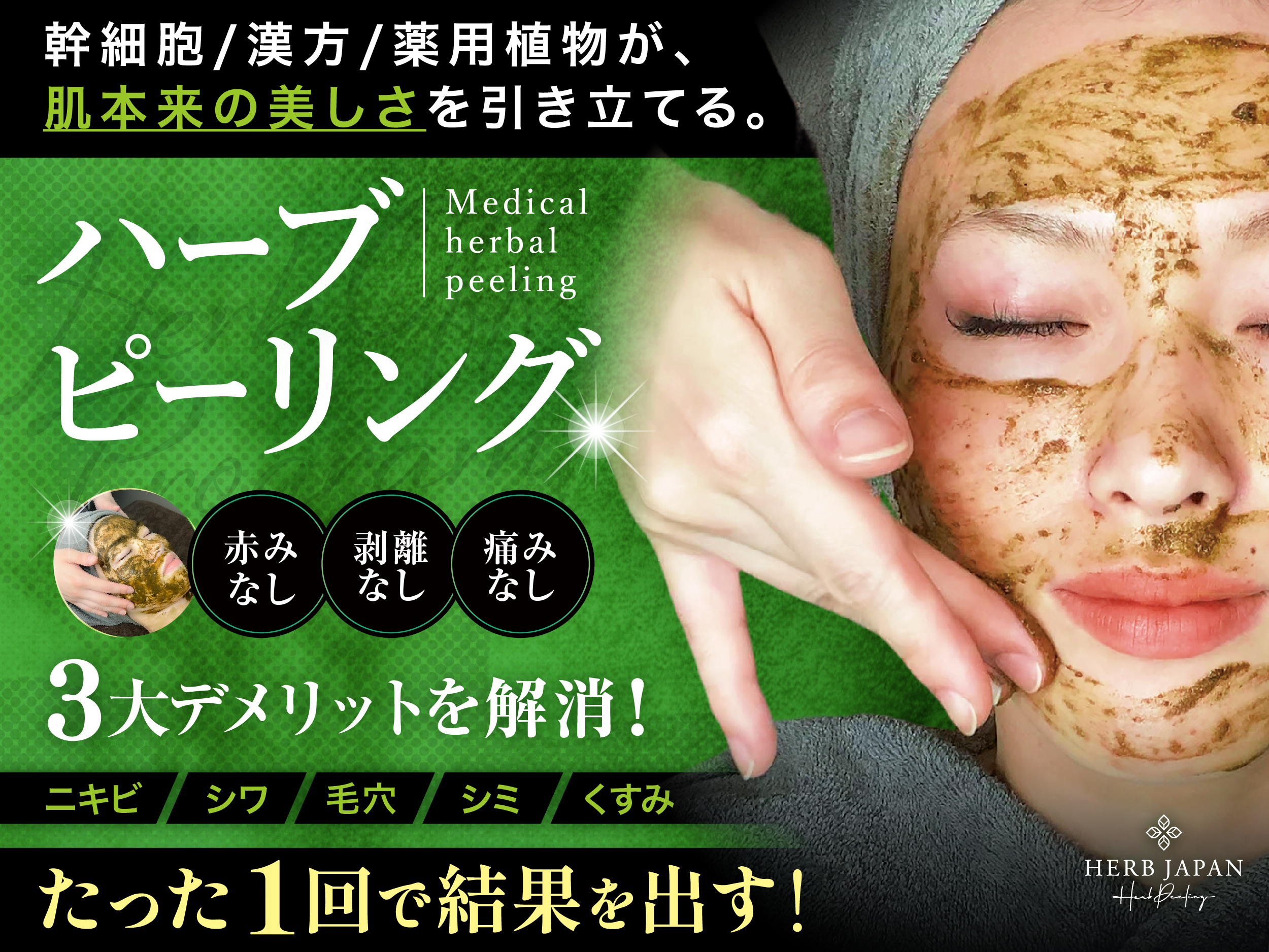 ハーブジャパン メディカルハーブピーリング 赤みなし・剥離なし・痛みなし