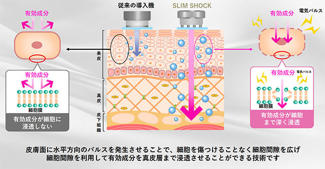 業務用エステ機器 エレクトロポレーションとは？