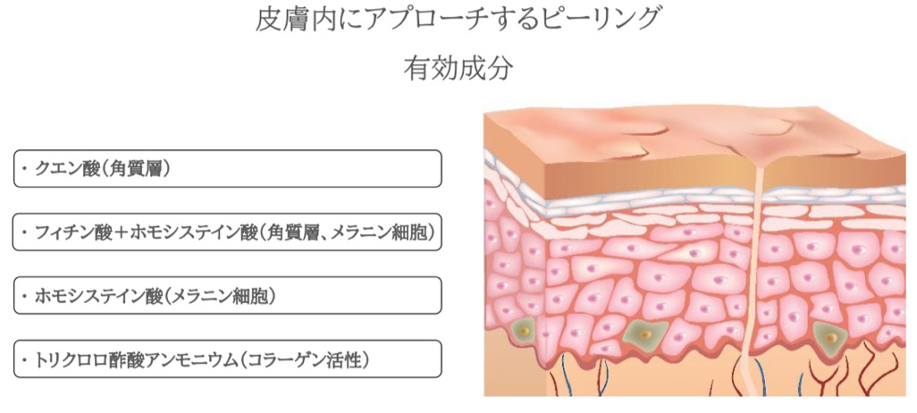 皮膚内にアプローチするピーリング